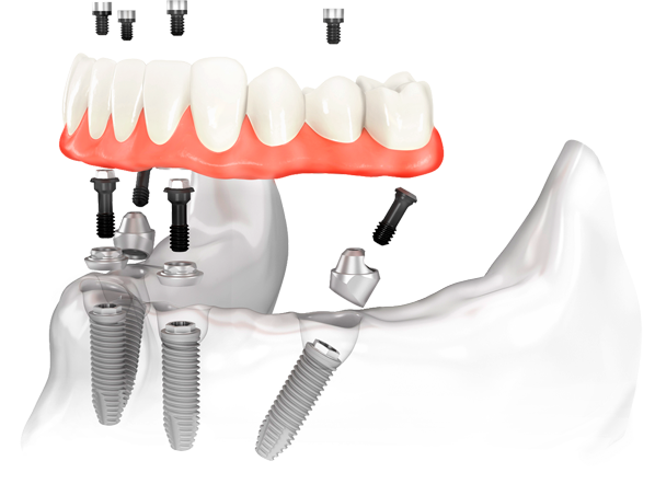 jaw